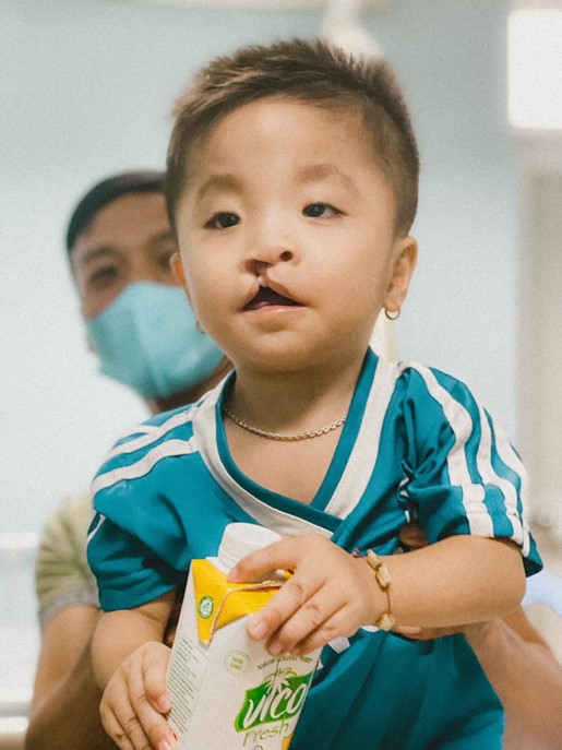 CÔNG TY CỔ PHẦN CHẾ BIẾN DỪA Á CHÂU ACP ĐỒNG HÀNH CÙNG OPERATION SMILE VIỆT NAM TRÊN HÀNH TRÌNH MANG ĐẾN NỤ CƯỜI CHO NHỮNG TRẺ KÉM MAY MẮN